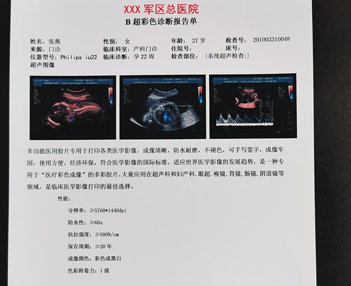 郑州医用超声胶片